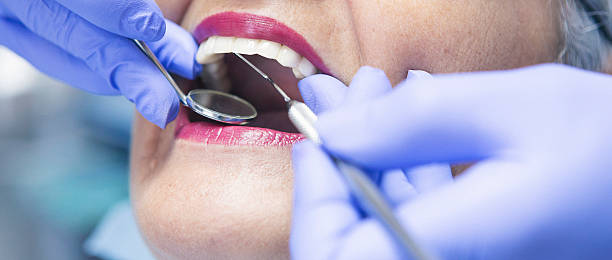Best Emergency Tooth Extraction in Newport, KY